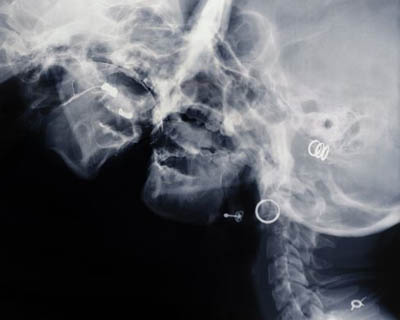 wim delvoye - kiss - le bastart