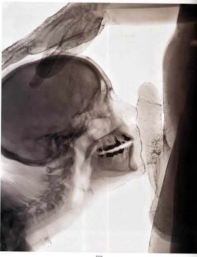 wim delvoye - kiss - le bastart