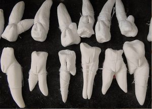 anammusma - dientes vulvados - le bastart